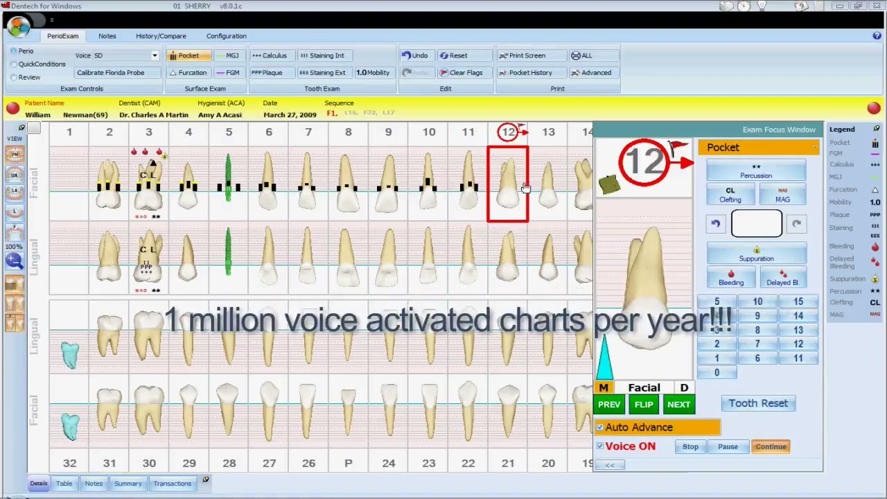 Ilt Chart Software Perio Charting Uk
