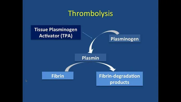 TEDNETS - Medical Management of Pulmonary Embolism...