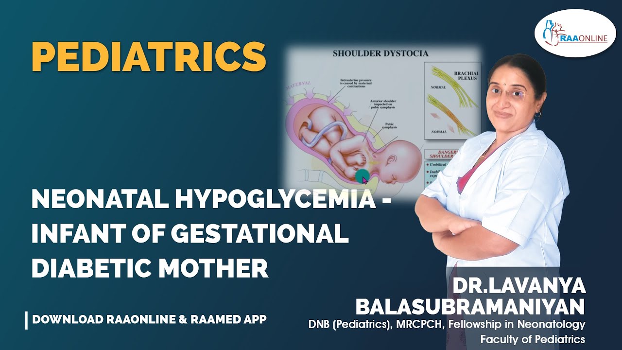 Neonatal Hypoglycemia - Infant of gestational diabetic mother