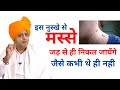 मस स जड स ख त म करन क ल ए How To Remove Warts Permanently Sanyasi Ayurveda 