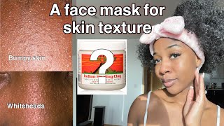How to use Aztec healing clay to remove bumpy skin texture‼️