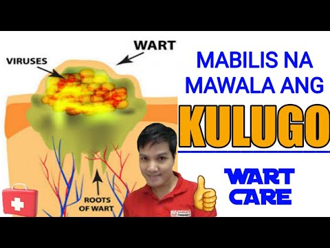 Video: Cornflower. Ang paglaki mula sa buto ay madali