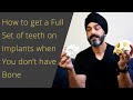 3 Ways to Have a Full Set of Dental Implants When You Don't have Enough Bone