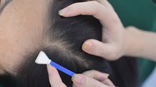 ASMR Hair Parting No Talking, Real Person Scalp Scratch, Scalp Massage For Reduce Headache
