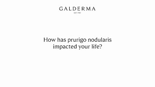 Living With Prurigo Nodularis Eugenias Story