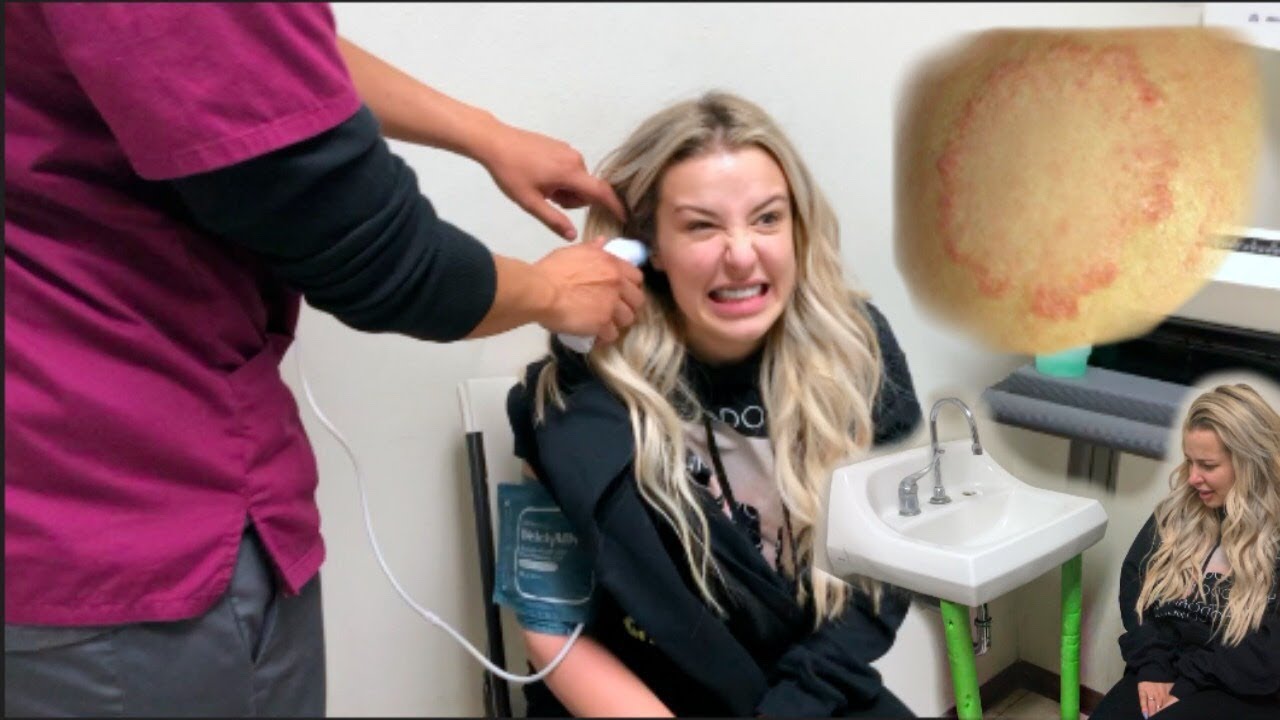 I Treated My Ringworm At The Lowest Reviewed HOSPITAL In LA (1 STAR) - YouTube