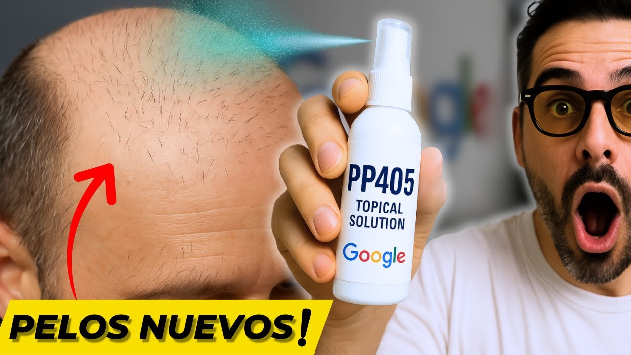 ¿El fin de la calvicie? PP405 sorprende con resultados REALES en solo 4 semanas 🧴