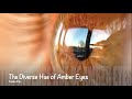 The Diverse Hue of Amber Eyes