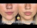 HOW TO FAKE FULL LIPS / how i fake lip filler