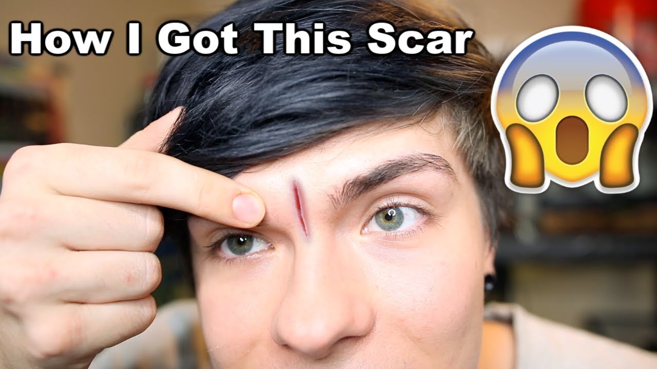 tyler rugge social blade What I Did Before I Kept Animals & How I Got This Scar