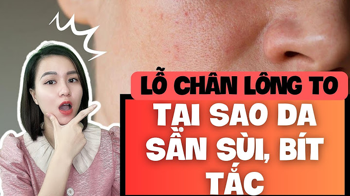 Da con nguoi co bao nhiêu lỗ chân lông