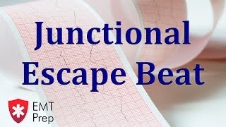 Junctional Escape Beat ECG - EMTprep.com