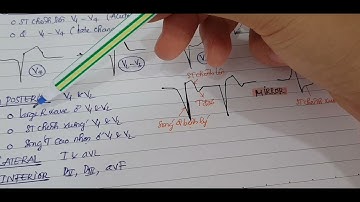 Tim mạch | Nhồi máu cơ tim | MI