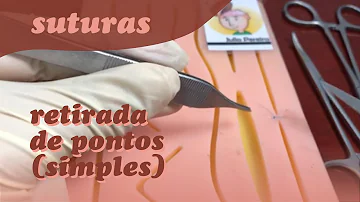 Como saber se os pontos de uma cirurgia estão inflamados?