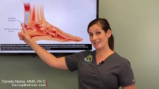 Treating Heel Bursitis and Achilles Tendinopathy with PRP Prolotherapy Resimi