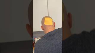 I Got Smacked With Cheese