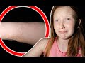 ESMÉ FELL DOWN A DITCH INTO STINGING NETTLES!! (CRAZY SKIN REACTION!!)