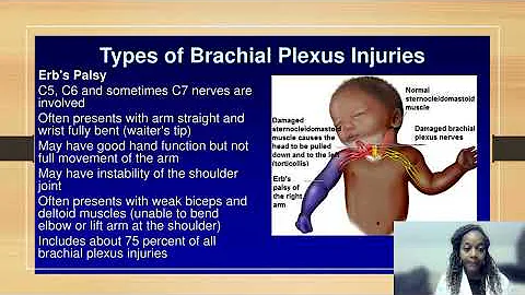 Brachial Plexus in Pediatrics   Spring 2022