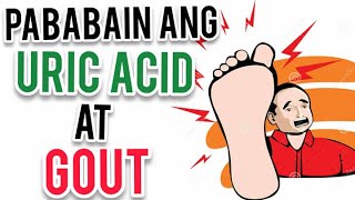 Pababain ang Uric Acid at Gout - by Doc Liza Ramoso-Ong #337