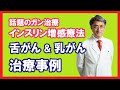 舌ガン・炎症性乳ガンの治療例 症状改善までの道のり