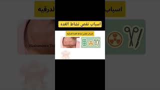 اسباب نقص نشاط الغده  #ahmed_pharmacy #fypシ #viral #الغدة_الدرقية