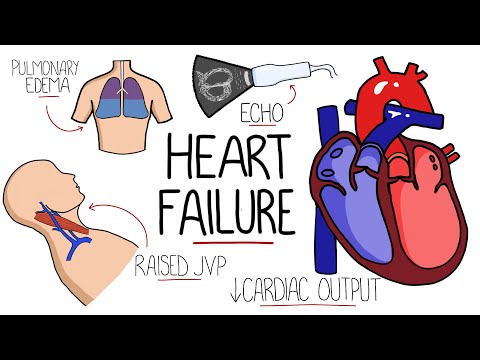 Heart Failure Explained - HFrEF vs HFpEF (Systolic vs Diastolic Heart Failure)