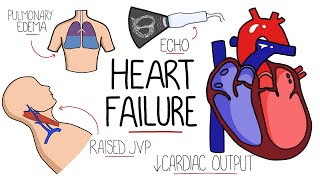 Heart Failure Explained - HFrEF vs HFpEF (Systolic vs Diastolic Heart Failure)