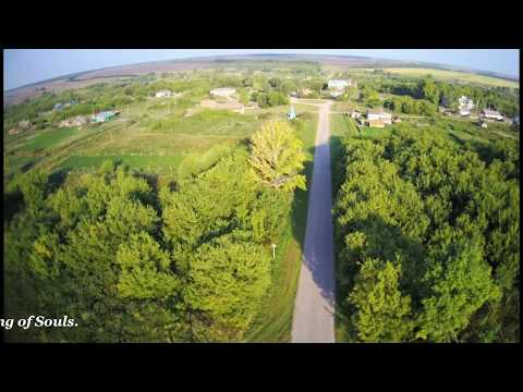 Видео: Челно босиране: причини, признаци и диагноза