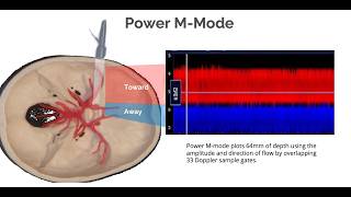 Mastering M-mode for improved efficiency.