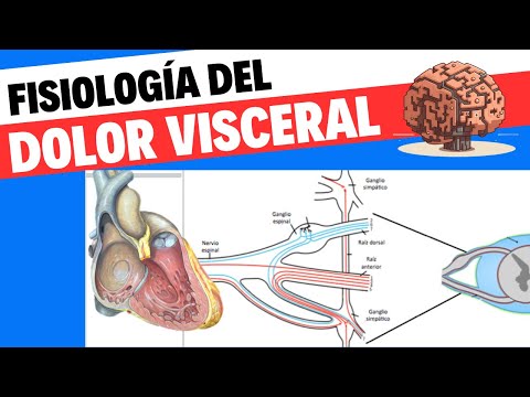 Vídeo: Dolor Somático Versus Dolor Visceral: Lo Que Debe Saber