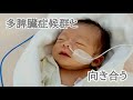 【手術①】多脾臓症候群と向き合う/指定難病/新生児の初外出/シャント手術/心疾患