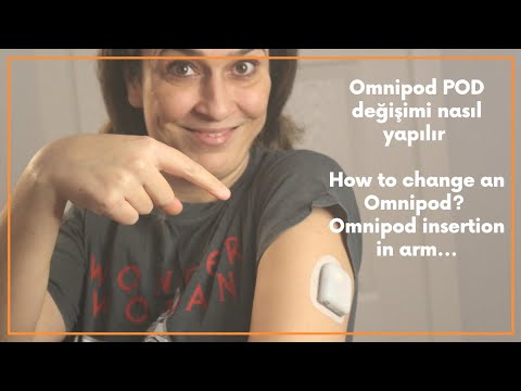 Omnipod POD değişimi nasıl yapılır? / How to change an Omnipod? Step by step!