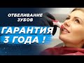 Отбеливание зубов в Киеве. Гарантия 3 года❗️ "Лаборатория белого цвета"