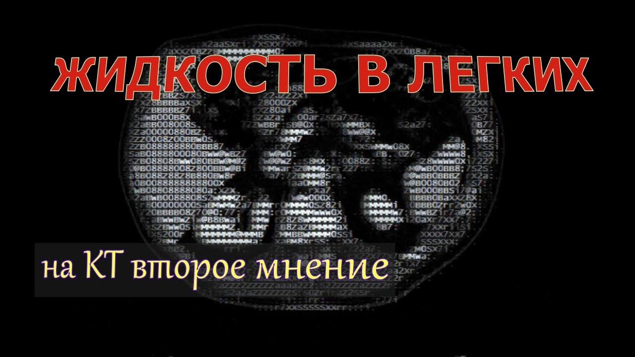 ЖИДКОСТЬ В ЛЕГКИХ, КАНЦЕРОМАТОЗ плевры и ОПУХОЛЬ легкого на КТ ...