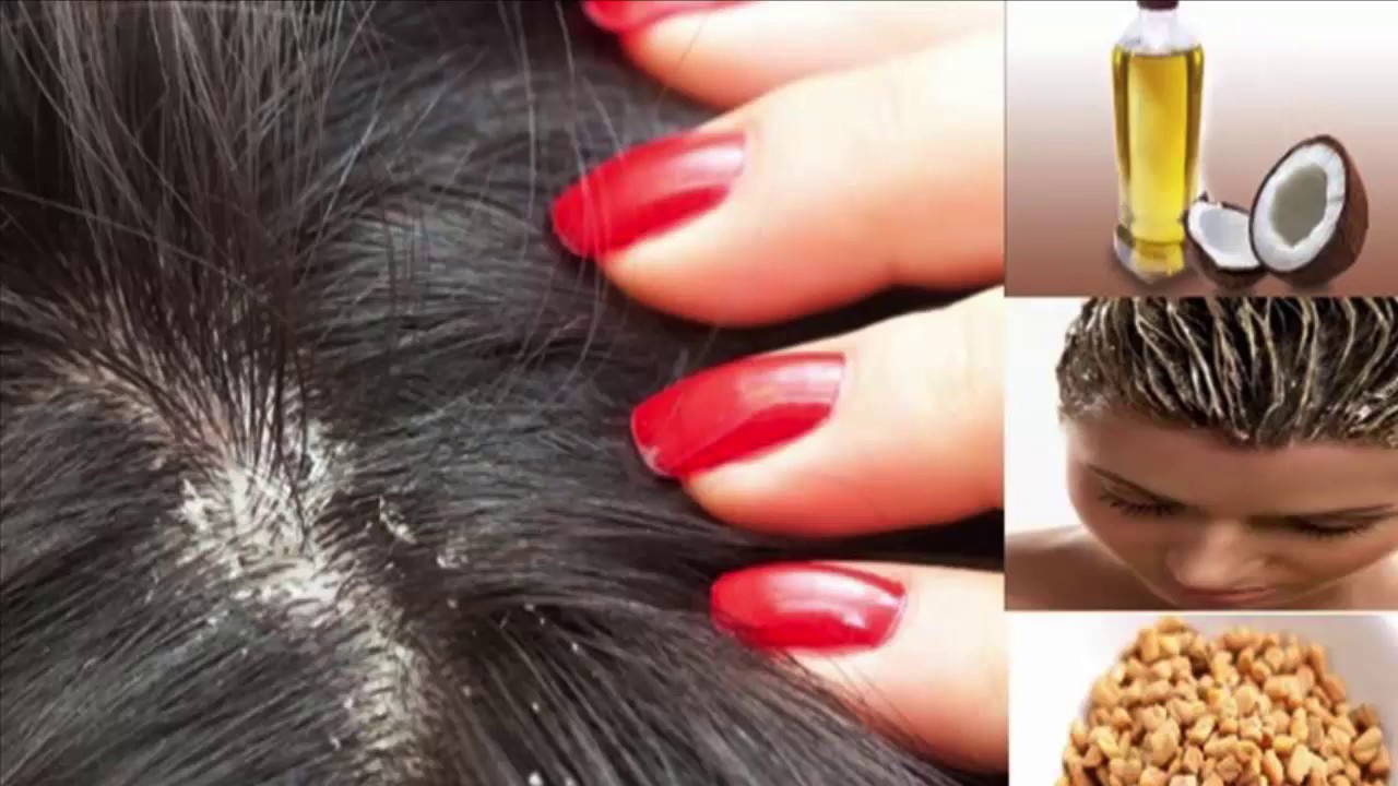 Best Dandruff Shampoo For Color Treated Hair Anti Dandruff Shampoo Best Dandruff Shampoo For Color Treated Hair Anti Dandruff Shampoo