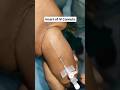 IV Cannula Insertion ✅✅ Cannula kaise lagate hain #cannulation #cannula #jackdarkvlogs #minivlog #jd