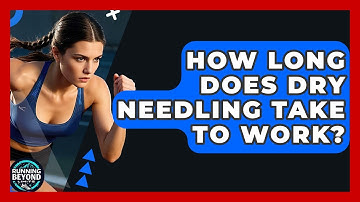 How Long Does Dry Needling Take To Work? - Running Beyond Limits