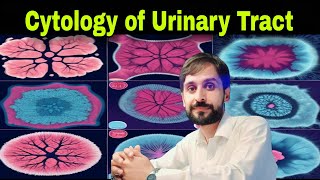 Urine Cytology | Urine Cytology Test | Cytology of Urinary Tract | MLT Hub with kamran