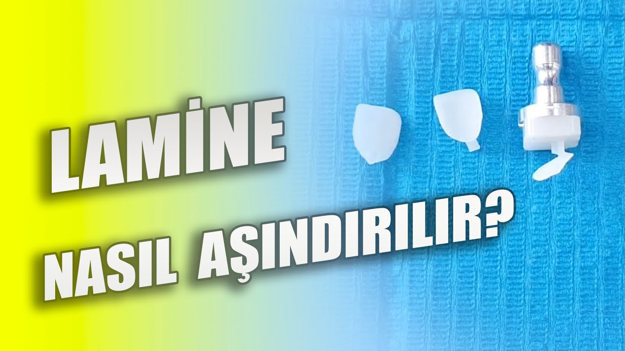 Lamine Nasıl Aşındırılır? Lamine Diş Çeşitleri Nelerdir?