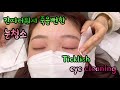 Ticklish eye cleaning/간지러워서 죽을뻔한 눈청소/かゆくて死にそうな目の掃除/痒得要死地洗眼