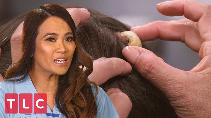 Lisa Has a "Horn" Coming Out of Her Head | Dr. Pim...