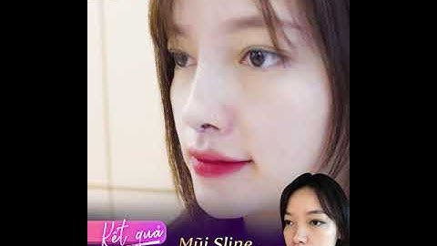 Ngắm Nhìn Kết Quả Nâng Mũi S Line Siêu Đẹp #shorts | Dr Hoàng Tuấn