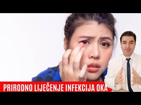 Video: 10 Dokazanih Kućnih Lijekova Za Infekcije Oka