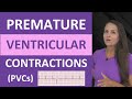 Premature Ventricular Contractions (PVCs) Quiz