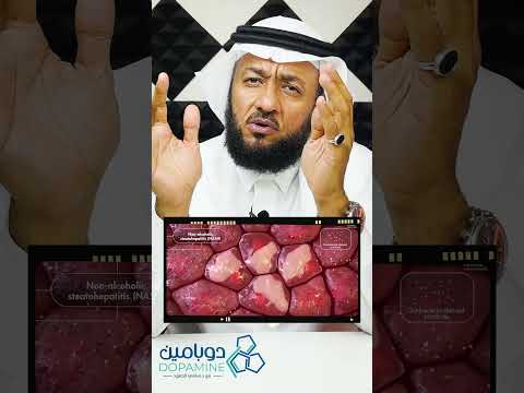 خطير معركة الكحول في الكبد