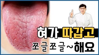 위축성설염 경면설/ 혀가 쪼글쪼글해요. 혓바닥이 아파요