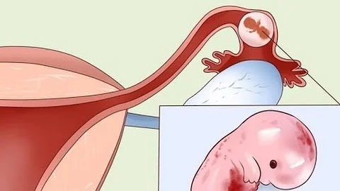 ¿Qué ayuda a la implantación tras la ovulación?