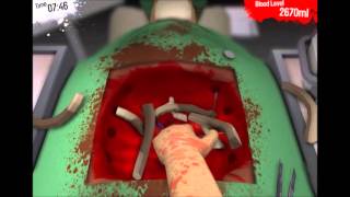 Surgeon Simulator Gameplay