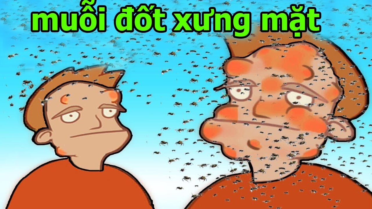 Games Vui Cực Bựa Đập 100 Con Muỗi để không bị đốt sưng mặt - Mosquito ...