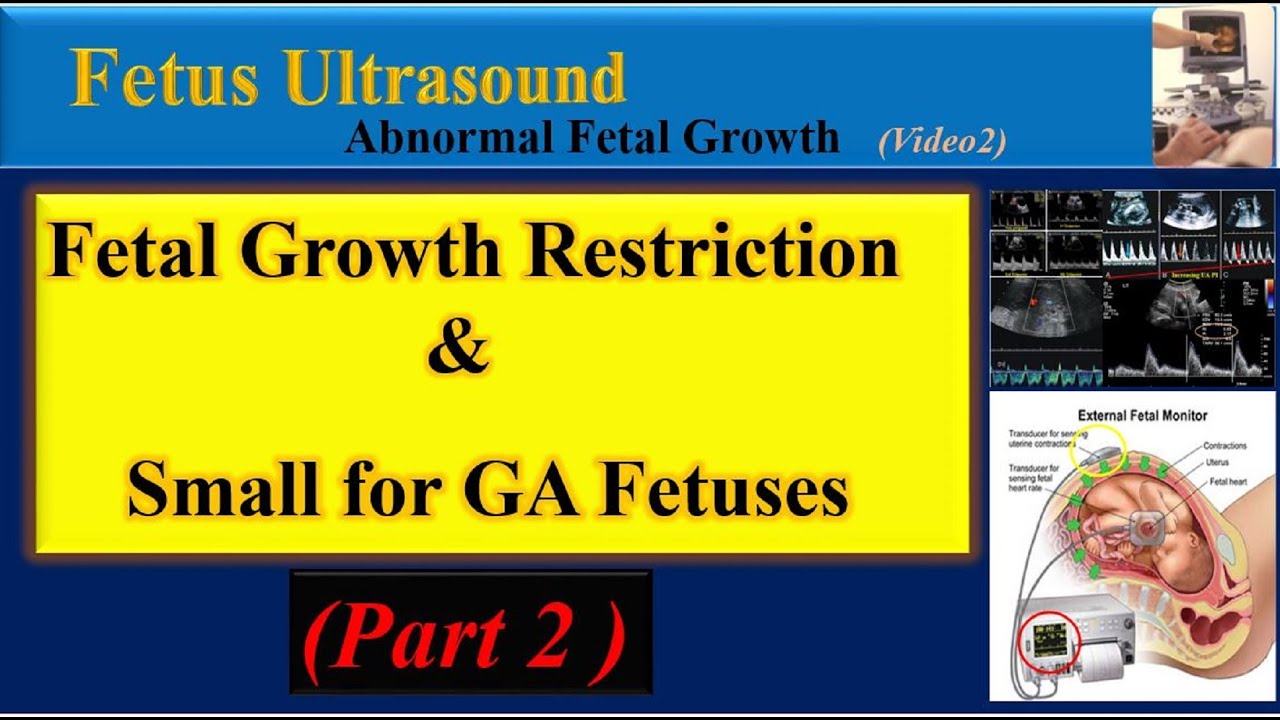 Fetus ultrasound fetal growth restriction and small for gestational